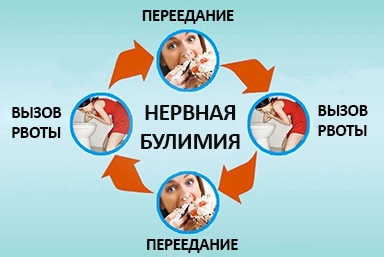 Лечение булимии в Междуреченске